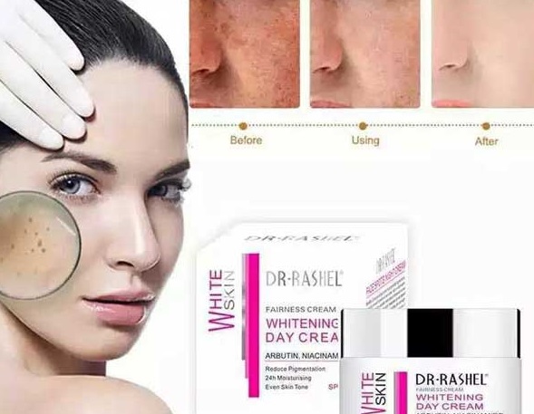 کرم ضدلک دکترراشل